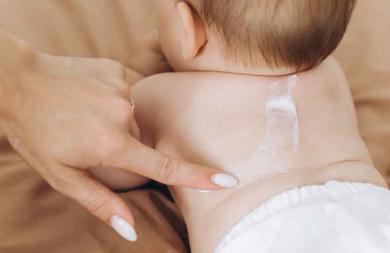 Eczéma : les bons gestes du quotidien font souvent la différence-FCMRR