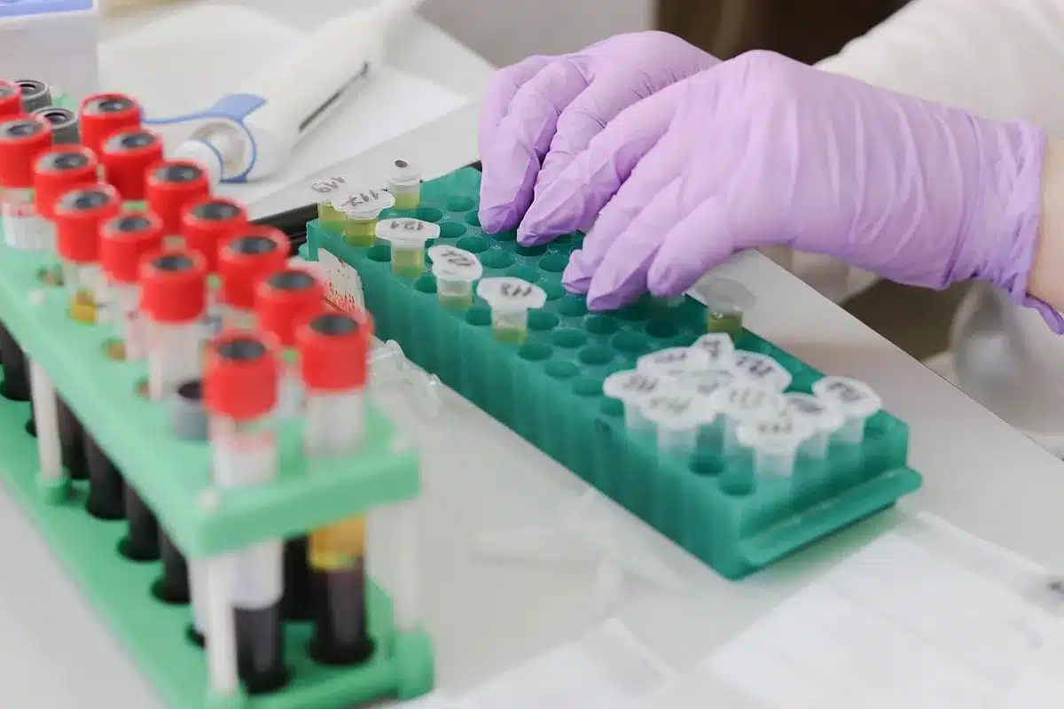 Échantillons d'ADN et dossiers sur une table de laboratoire illustrant une grande étude
