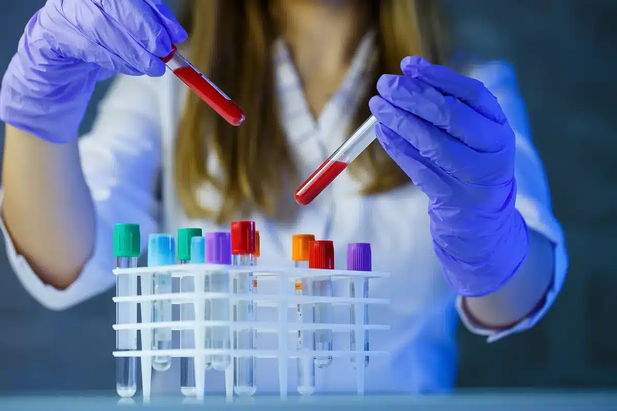 Échantillons fécaux et instruments de laboratoire montrant l'analyse du microbiote